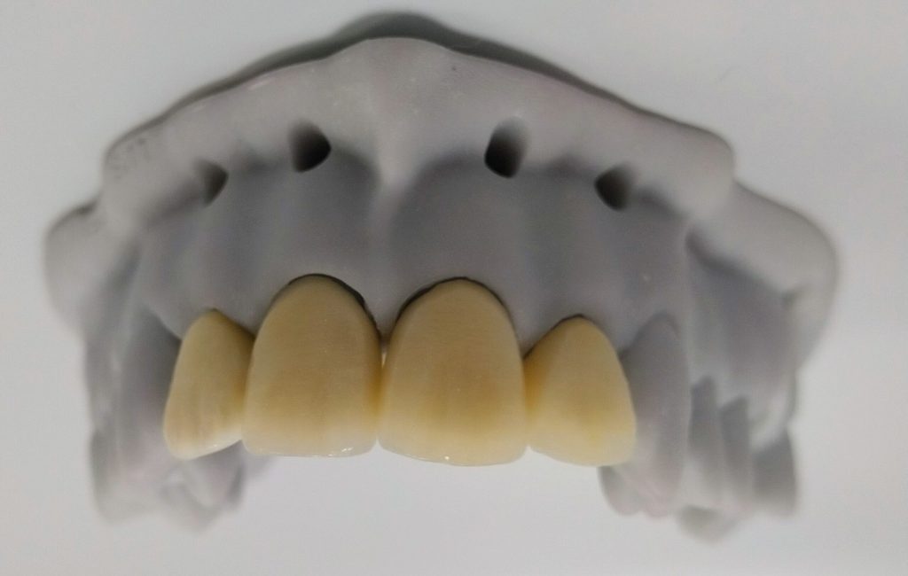 IMG_20200423_080159_751~2