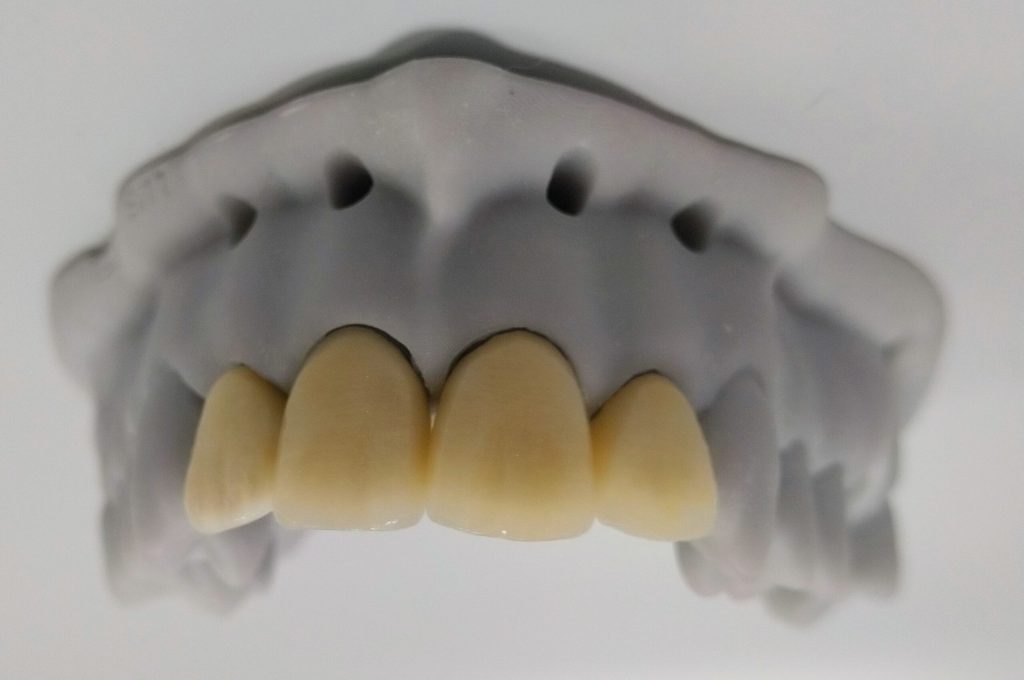 IMG_20200423_080159_751~2