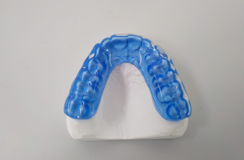 férula de bruxismo