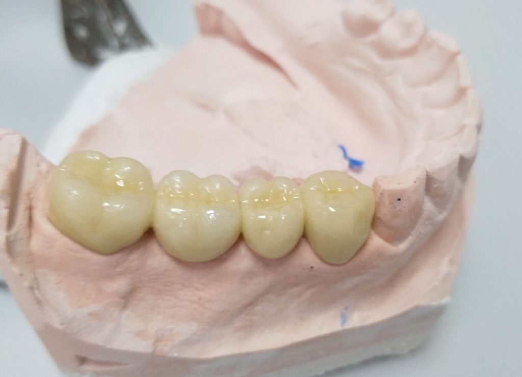 MVIMG_20190603_090147_807