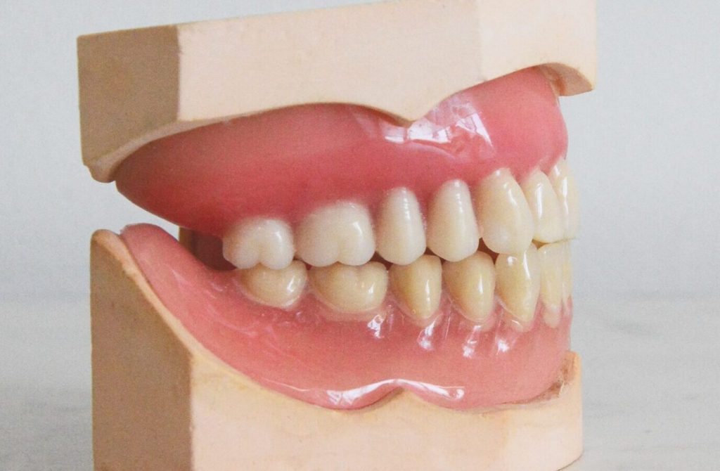 prótesis removibles