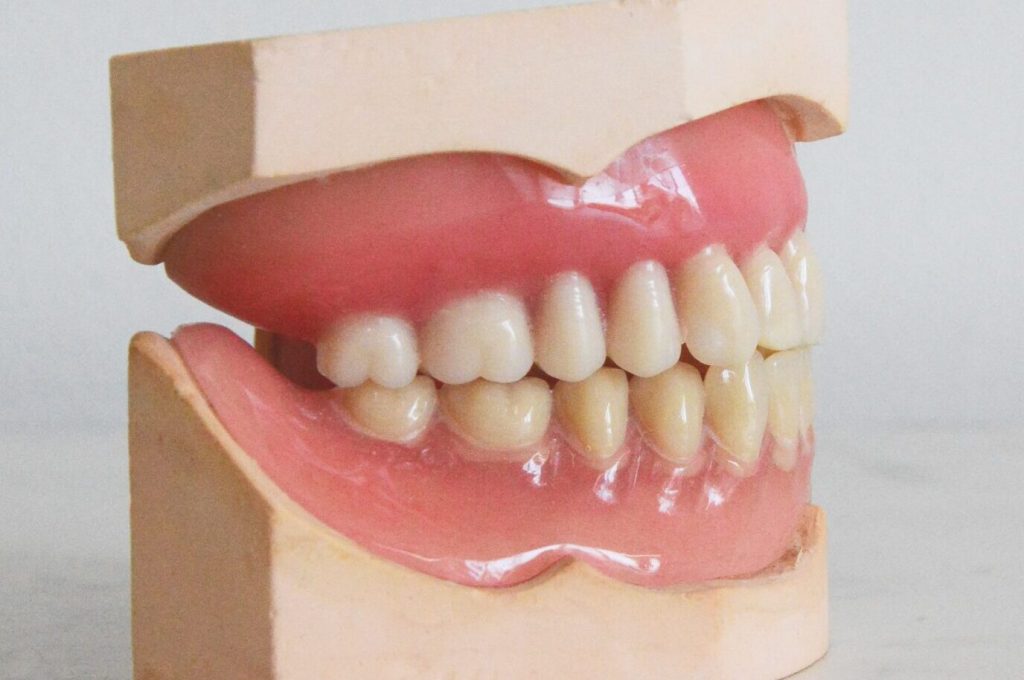 prótesis removibles