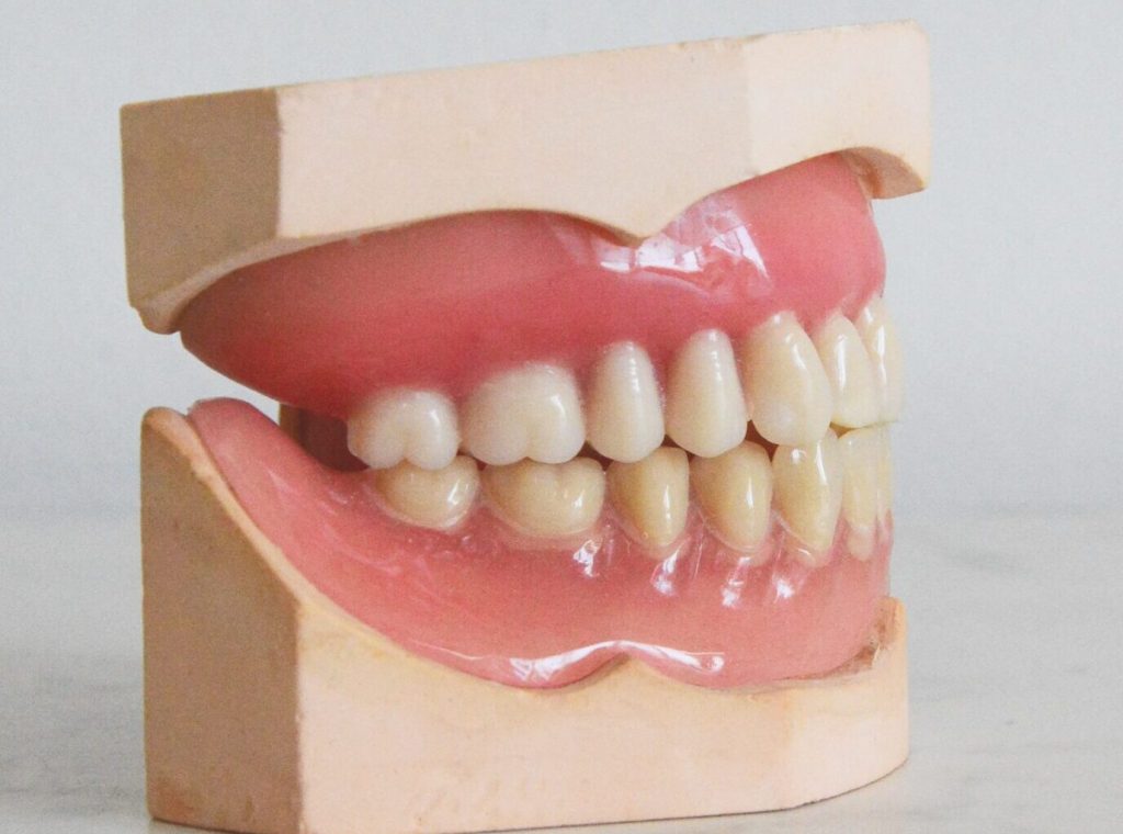 prótesis removibles