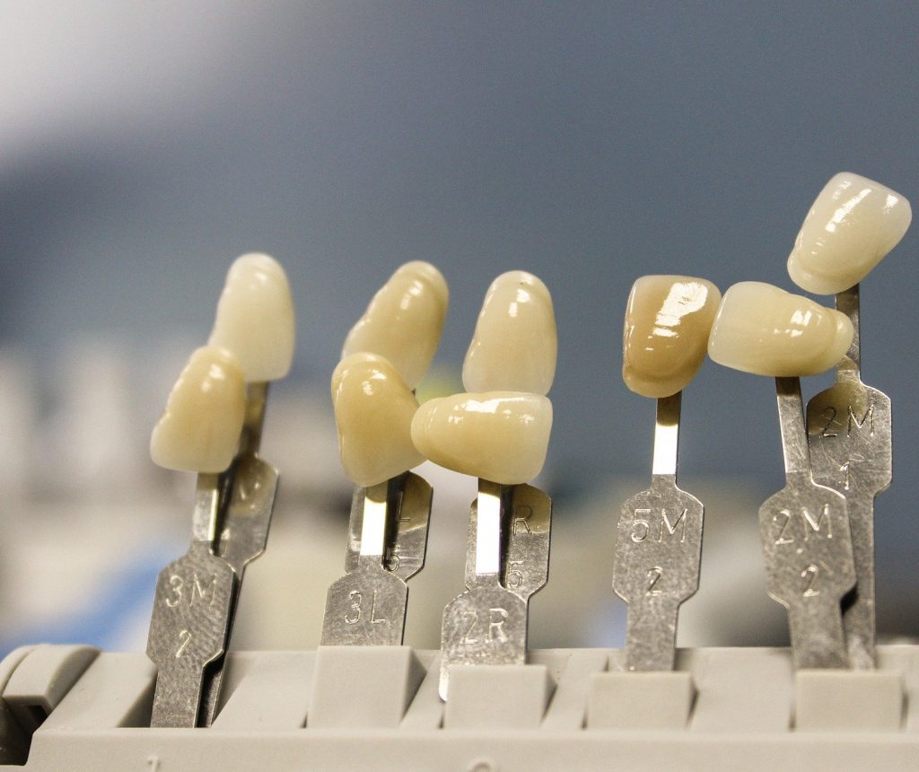 tooth-2068131_1920 - copia